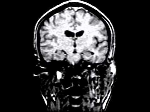 The thinking in the medical field is that attentional capacity and skills occur on a continuum. Pediatrics is evolving toward the idea of supporting attentional functioning in everyone.