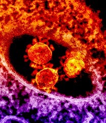 VIRUS. A picture of coronavirus particles. The coronavirus has spread to all over the world, but mainly focused in China. This has caused stores to close, bringing negative economic impacts.